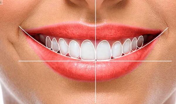 Estetica Dental