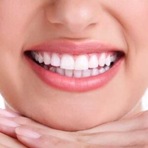 Diseño de Sonrisa