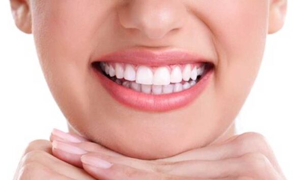 Diseño de Sonrisa