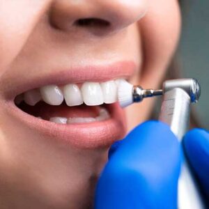 Limpieza Dental