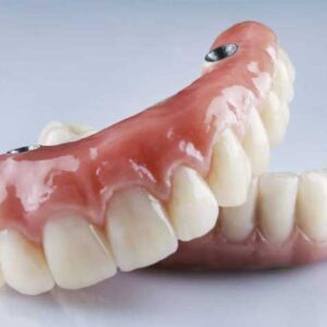 Prótesis Dental