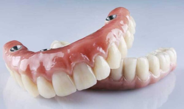 Prótesis Dental